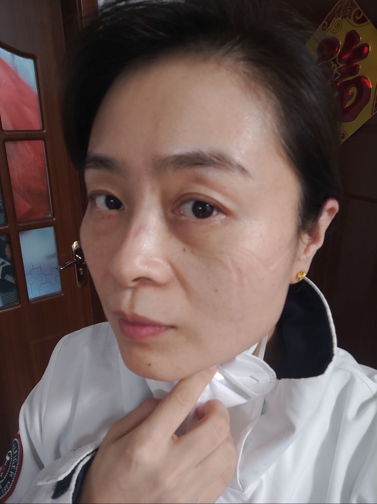 F225